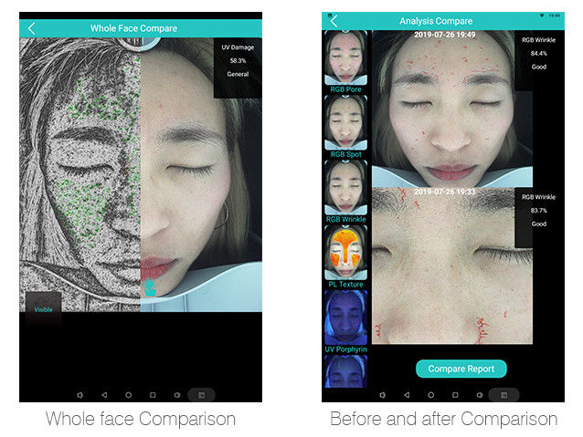 Smart Wrinkle Analysis 30 Million Clinical Databases For Salon Spa