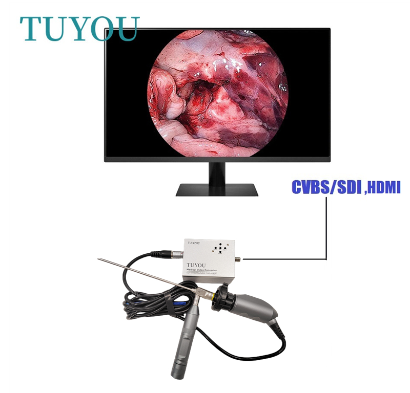 3 Meters Portable Medical Endoscope Camera For ENT Gynecology Urology