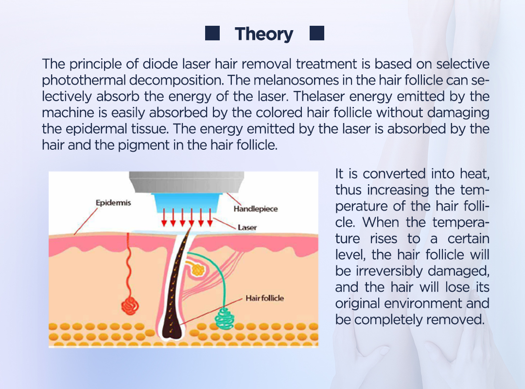 Diode Laser 755 808 1064 Hair Removal Painless