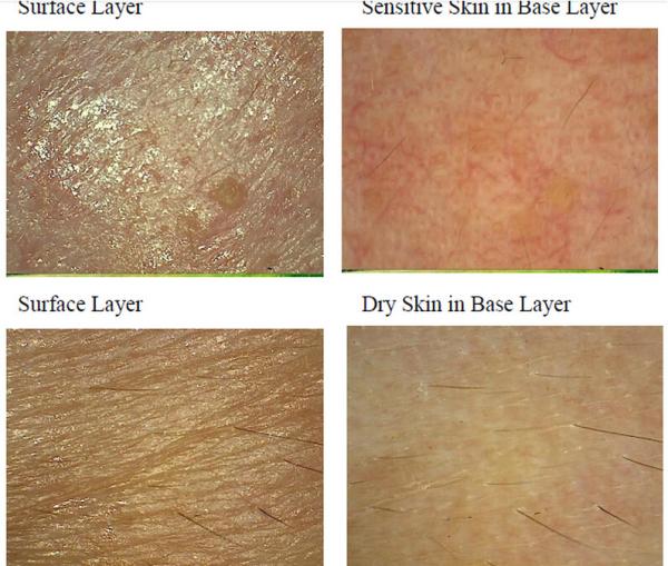 Facial Uv Skin Analyzer Machine For Skin Mositure / Grease / Wrinkle /