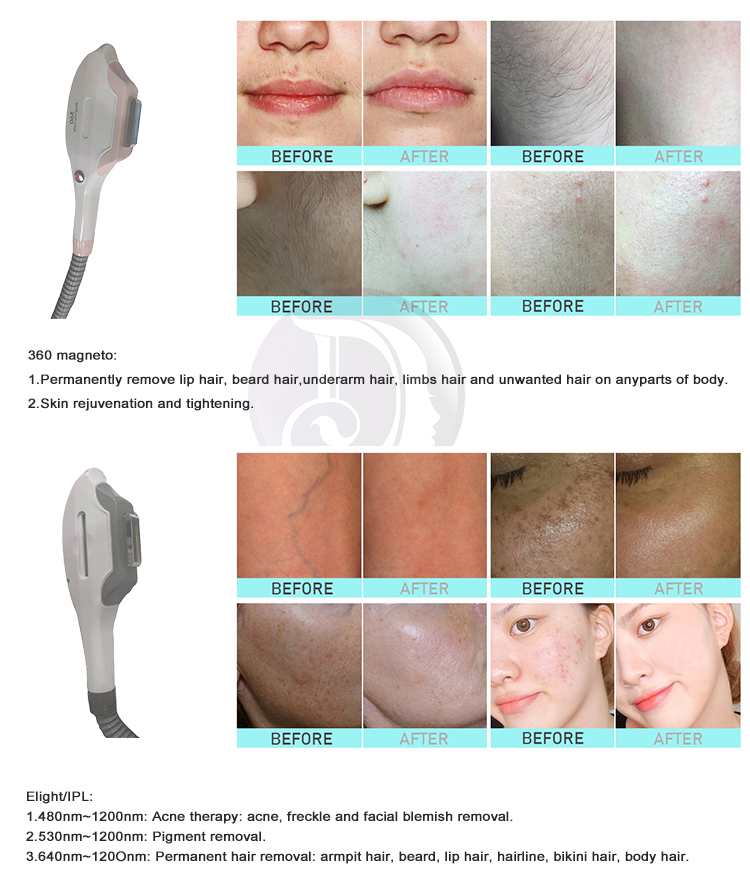 AS828 Multifunction Opt Ipl Machine , Rf 4 In 1 Ipl Nd Yag Hair Removal Machine