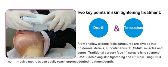 Face Lifting HIFU Machine / High Intensity Focused Ultrasound Machine Mini