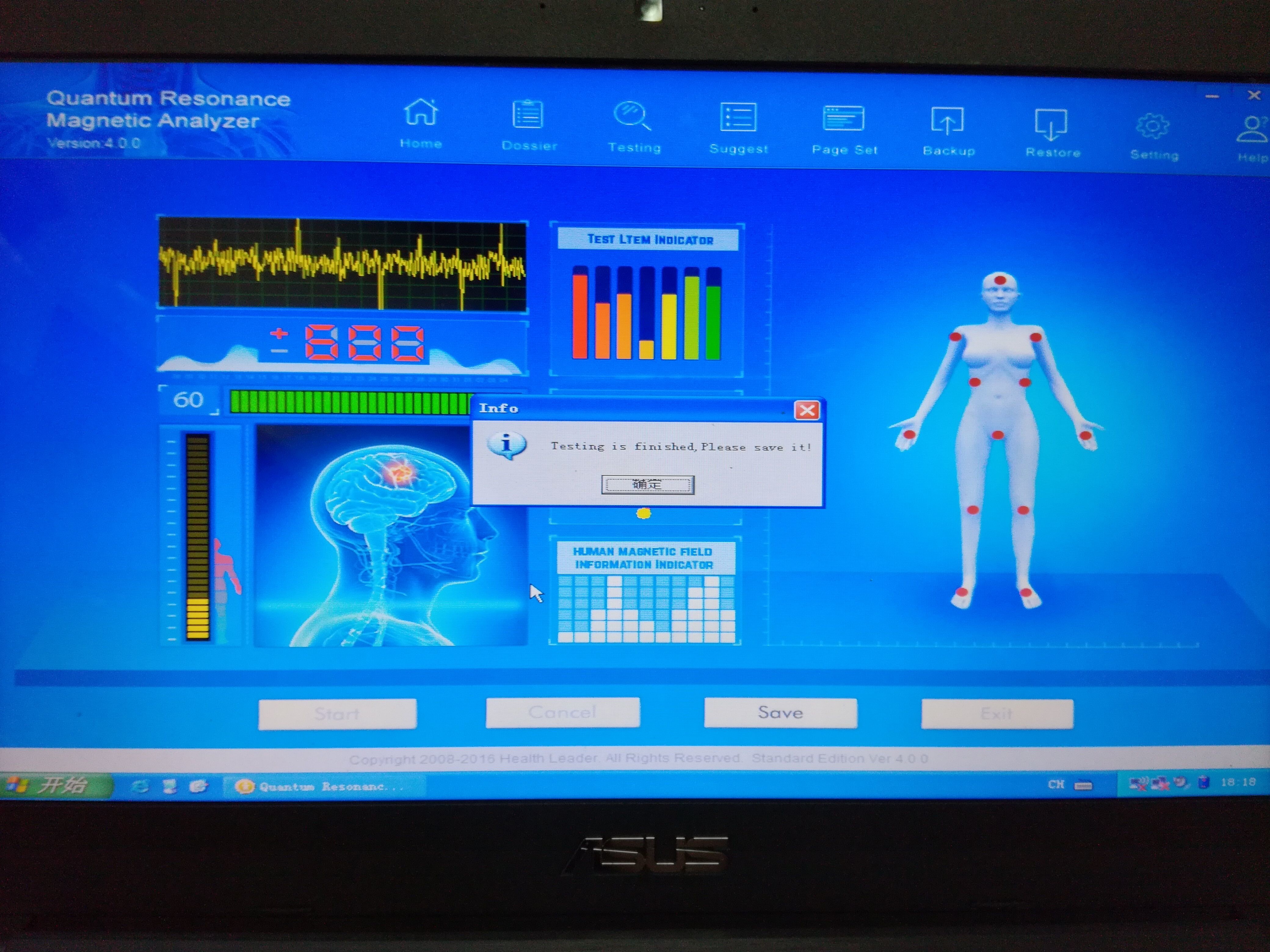 new 4th generation quantum analyzer 44 reports with CE approve