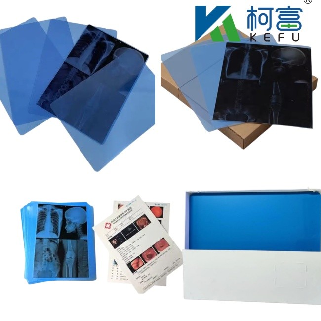 Sharpness High Medical X Ray Film With PET Base And Structure