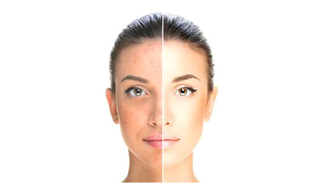 Whitening Youth Serum Injection Mesotherapy Skin Care Vitamin C Serum