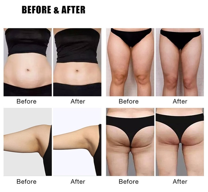 EMS EM Sculptingure Electromagnetic Slimming Body Machine Fat Burning Muscle Building 100hz Air Cooling System