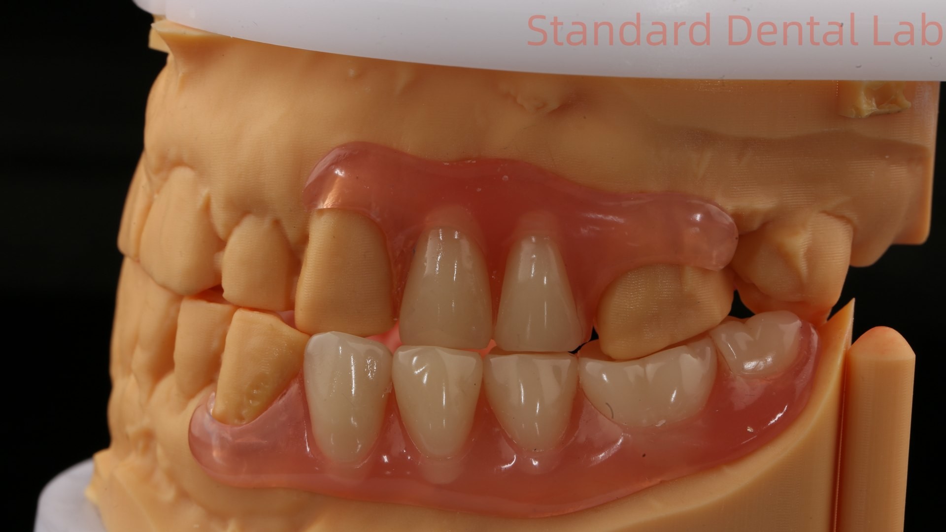 Dental TCS Valplast Flexible Partial Dentures Dental Lab 3D Print Model High Esthetics