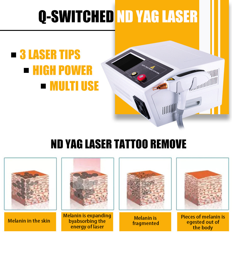 Portable 1064 532 1320nm Q Switched Nd Yag Laser Tattoo Removal Machine