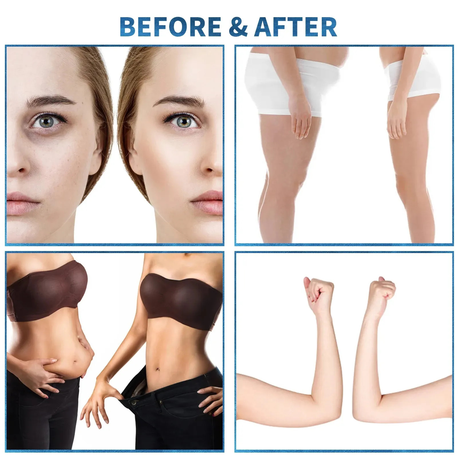 2 In 1 Vacuum Roller Slimming Machine , 3500W Body Contouring Lipo Laser Machine