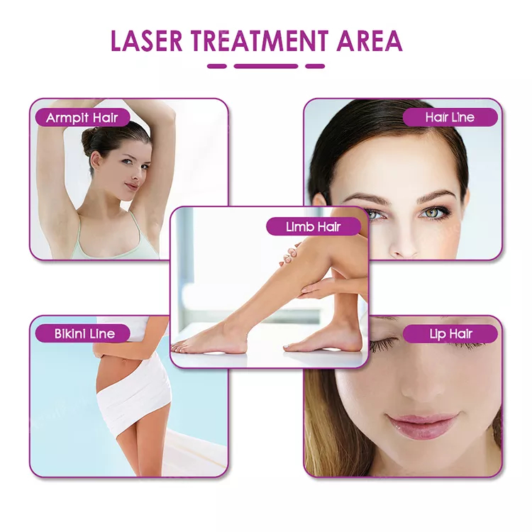 OEM Portable Professional 808nm Diode Laser Hair Removal Machine