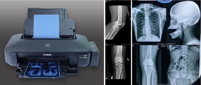 High Grade Roll Blue Laser Printing Medical X Ray Imaging Film