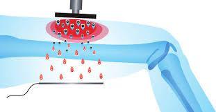 RF Tecar Microwave Diathermy Equipment For Muscle Relax