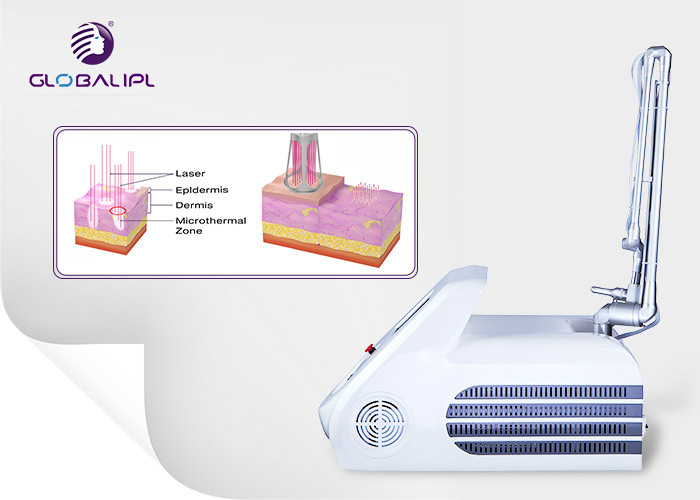 Portable Acne Removal Co2 Fractional Laser Equipment 50w Power Skin Whitening Device