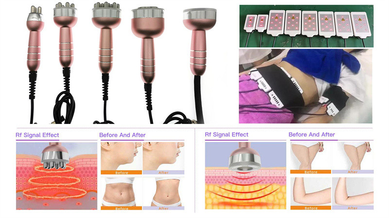 Rf 40k Cavitation Body Slimming Machine Ultrasonic Lipo Laser Pads