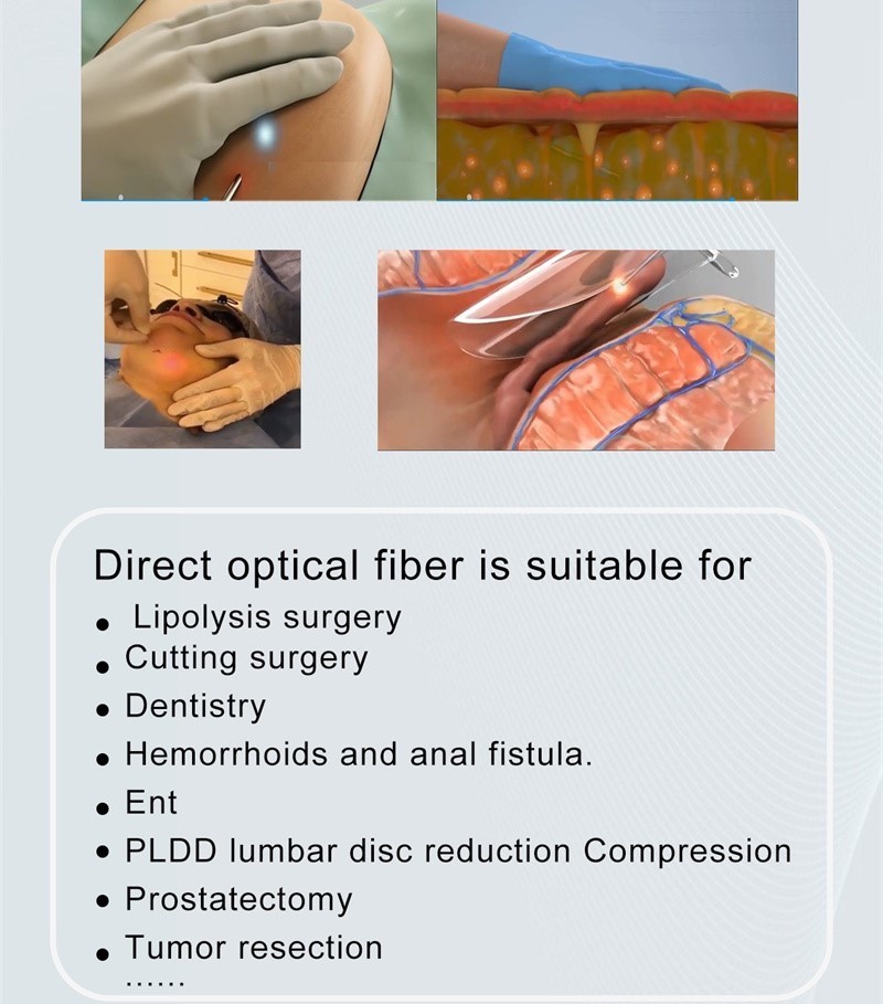 Fiber Laser Fat Reduction Portable Diode Laser Machine 980nm 1470nm Optical Laser