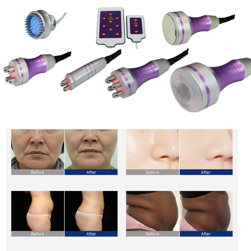Ultrasonic Liposuction Lipo Cavitation Machine Bio Lift S Shape With 7 Probes