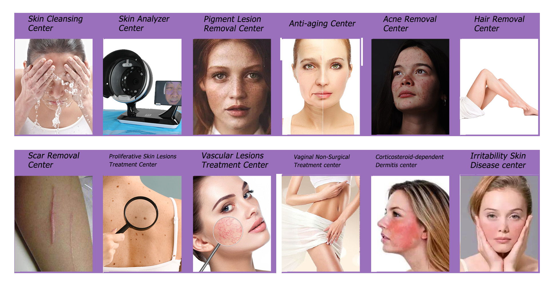 price power assisted RF roller 3 facial facial vacuum body vacuum suction machine