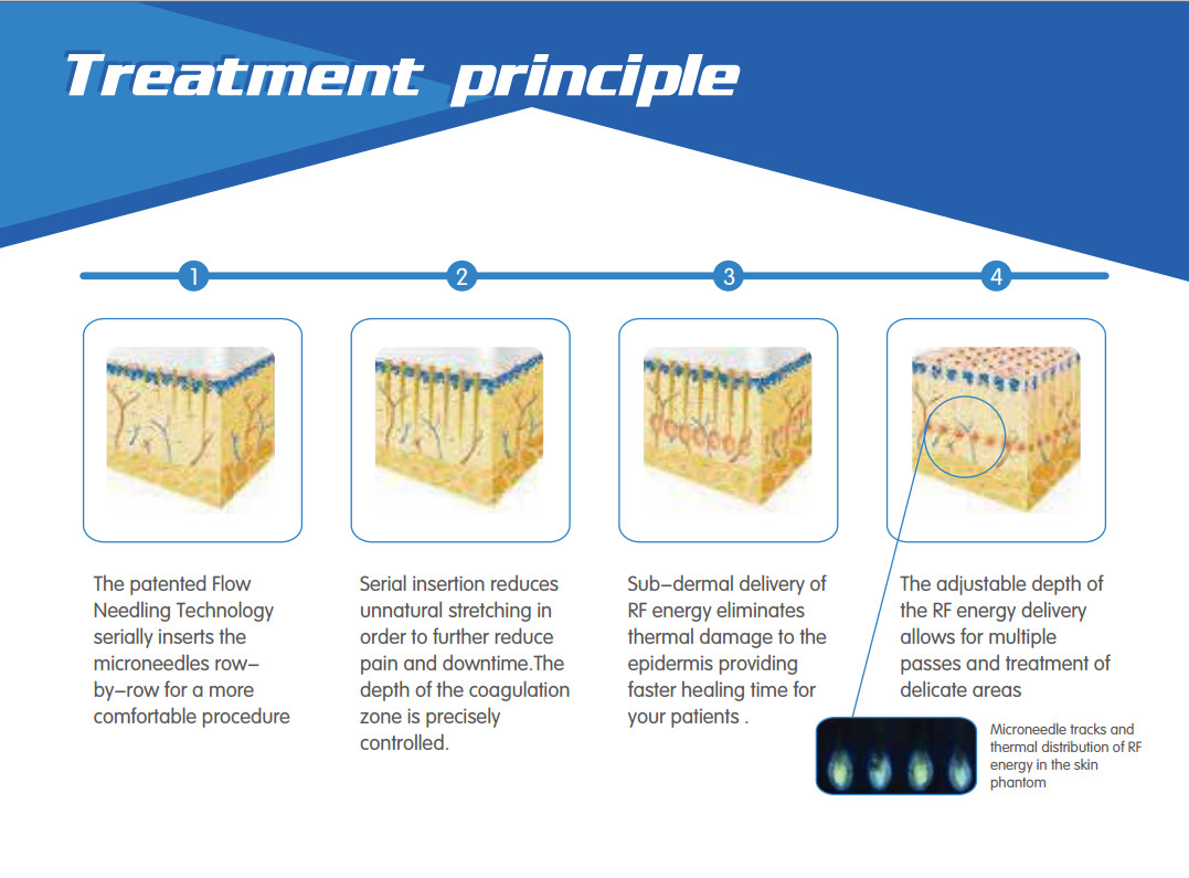 Skin maintenance micro needle nurse system secret microneedle fractional max rf skin treatment