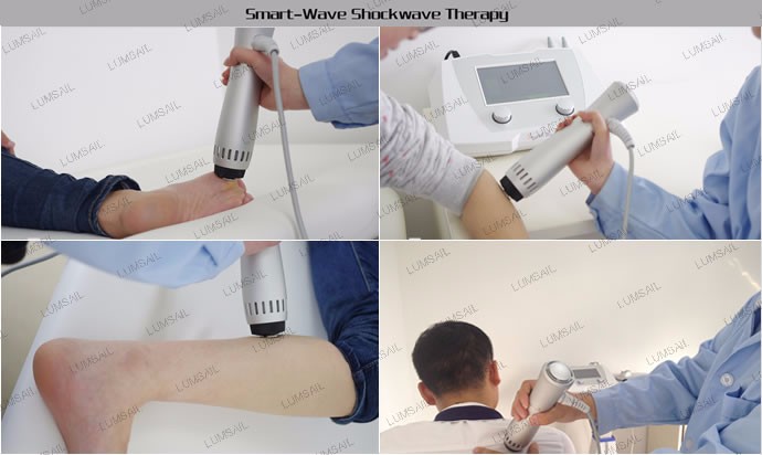 body slimming equipment Acoustic Wave therapy machine body reshaping body slimming cellulite remov
