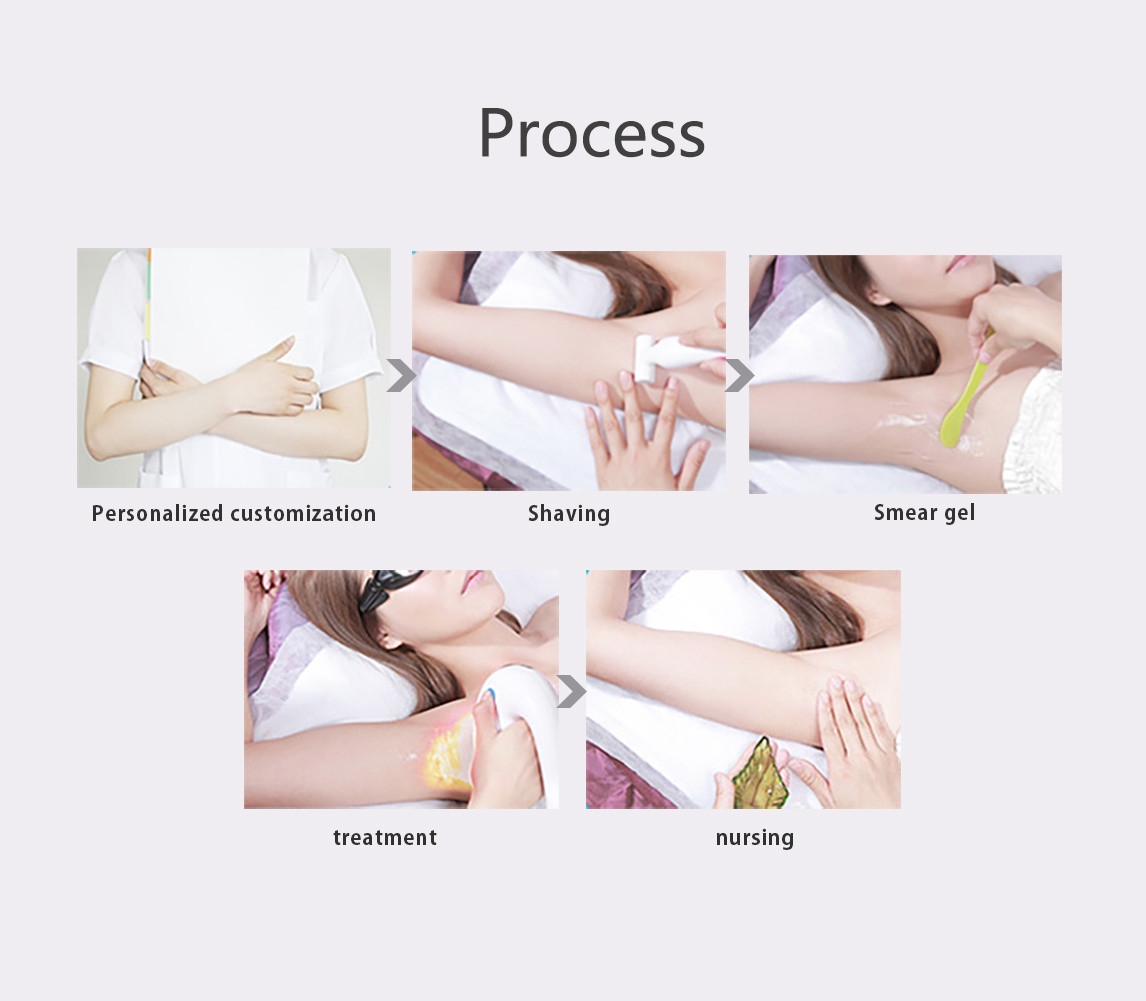 TUV CE Triple Wavelength Laser Hair Removal 2KW