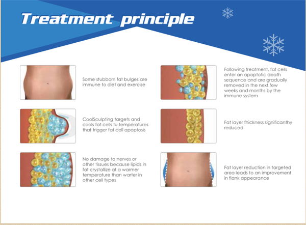 2017 Newest Professional Cryolipolysis Slimming Machine