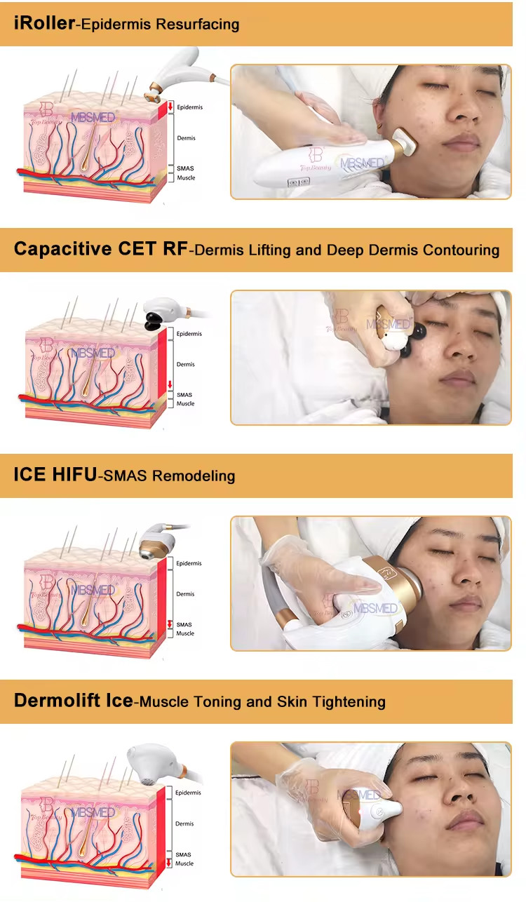 Ice Hifu Cooling Facial And Body Radiofrequency Face Lifting Cryo Hifu Smas Machine Skin Tightening