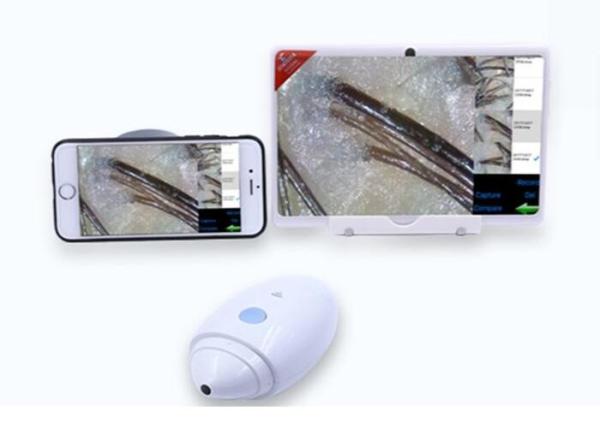 Digital Handheld Dermatoscope Video Skin Analyzer Resolution of 1080P with