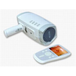 Lens Resolution 800000 Pixels Digital Electronic Colposcope With Automatic