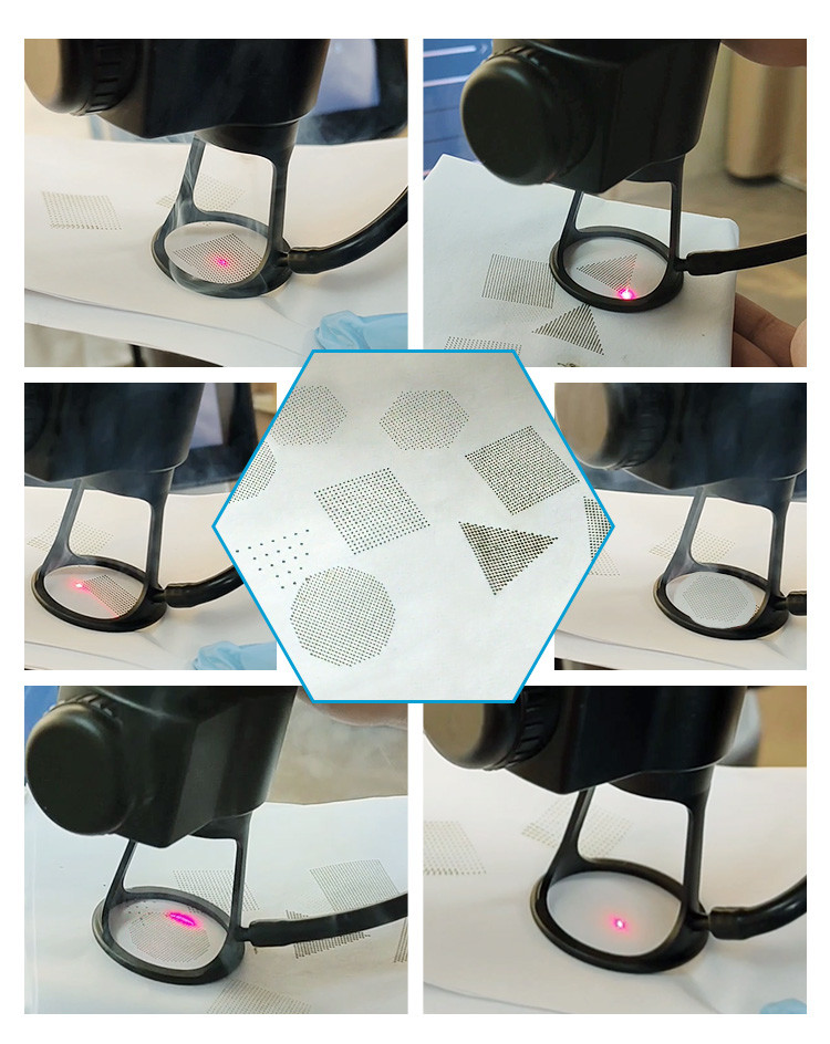 Advanced Co2 Fractional Laser Treatment 10600nm 7 Joints Arm Fractional CO2 Laser Machine For Acne Scars