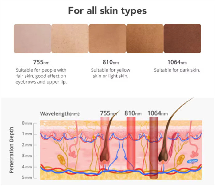 Q Switch 3 In 1 Nd Yag+Diode Laser+IPL Laser Hair Removal Beauty Machine