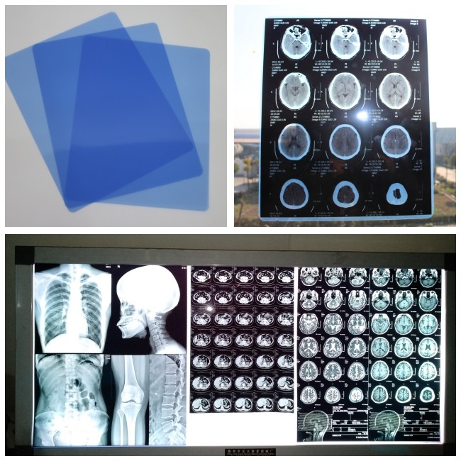 Blue Color Medical Film Inkjet for Canon ,Epson 210Micron Thickness