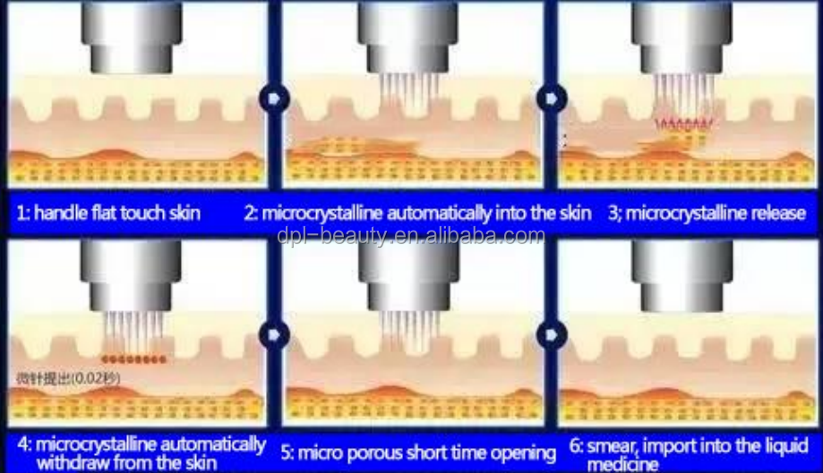 Wrinkle Removal RF Fractional Microneedling Machine Face Tightening With 25pins