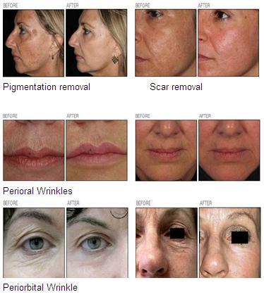 before-after picture.jpg