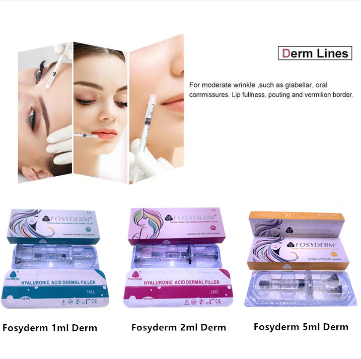 Face And Lips Fosyderm 1ml Derm Filler Removing Wrinkles