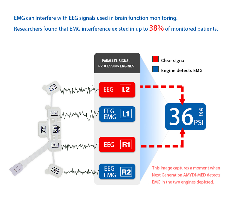 6 Electrodes Disposable Eeg Sensor Non Invasive Eeg Brain Sensor With Masim Modules Monitors