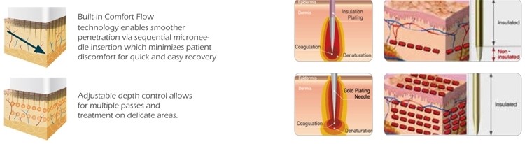Fractional RF Microneedle radio frequency machine microneedle mesotherapy skin resurfacing rf microneedle machine