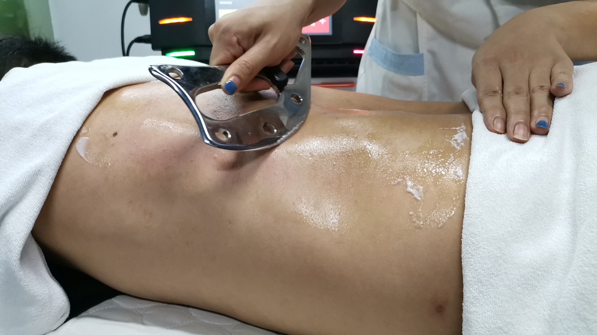 80Ma RMS Physical Therapy Beauty Machine Monopolar RF Wrinkle Removal