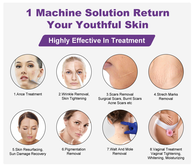 ZGV13-04 Latest Rf Tube Co2 Laser Skin Care Machine 30w Power Remove Acne Marks Remove Freckles And Scars Smooth Device