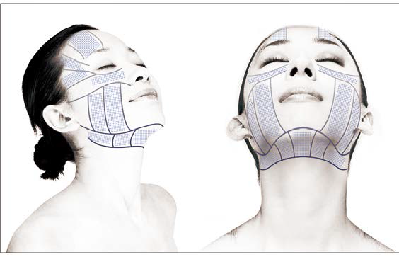 High Intensity Focused Ultrasound Vertical Equipment For Wrinkle Removal Treatment