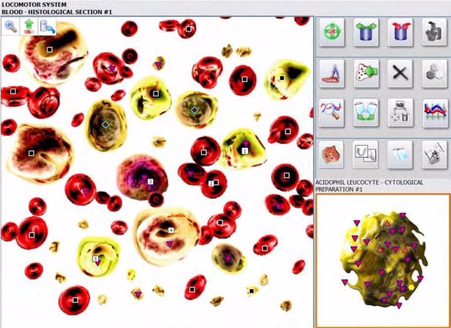 Metatron hunter 4025 with german software