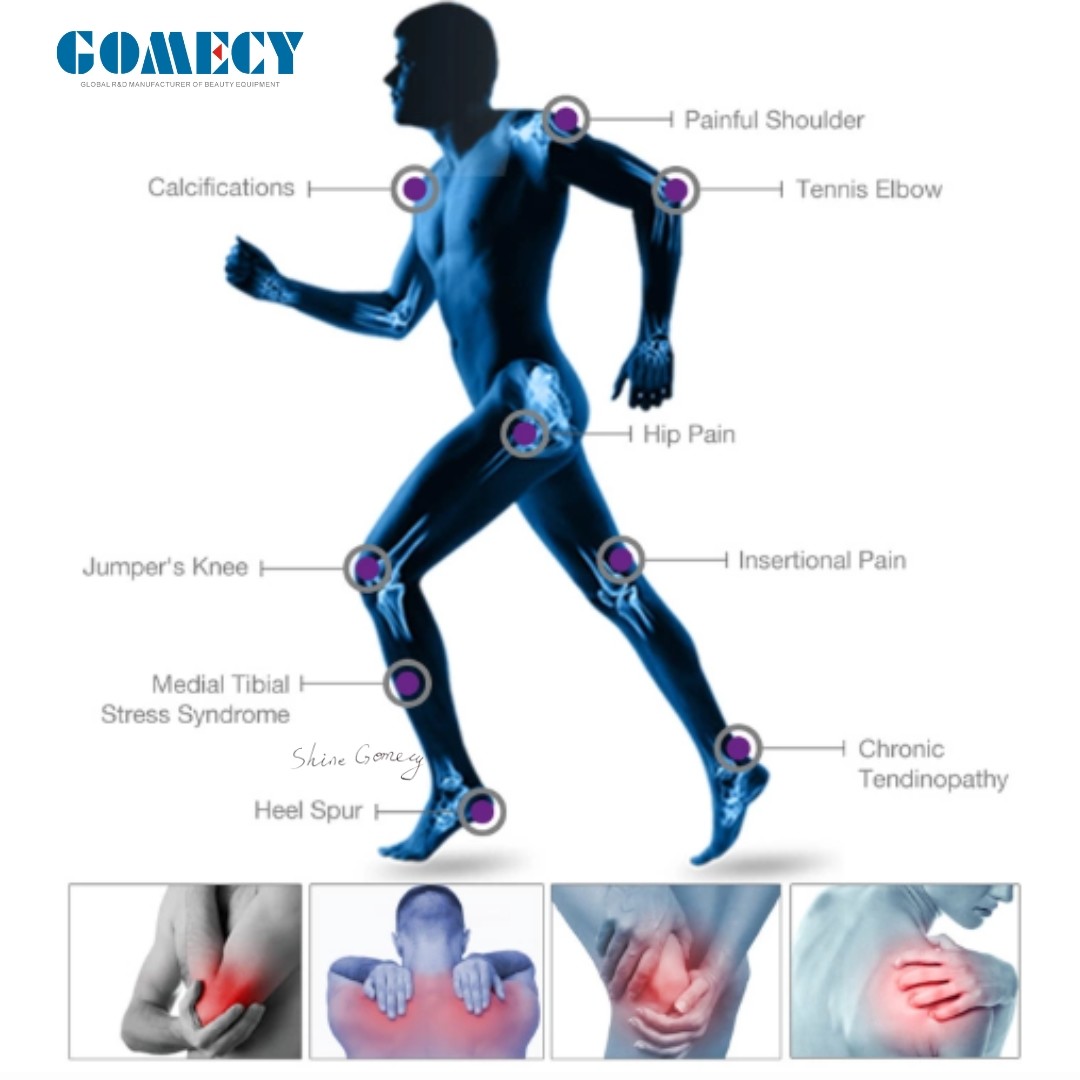 Professional Vertical Focus Shockwave Therapy Device for Effective ED Shockwave Therapy