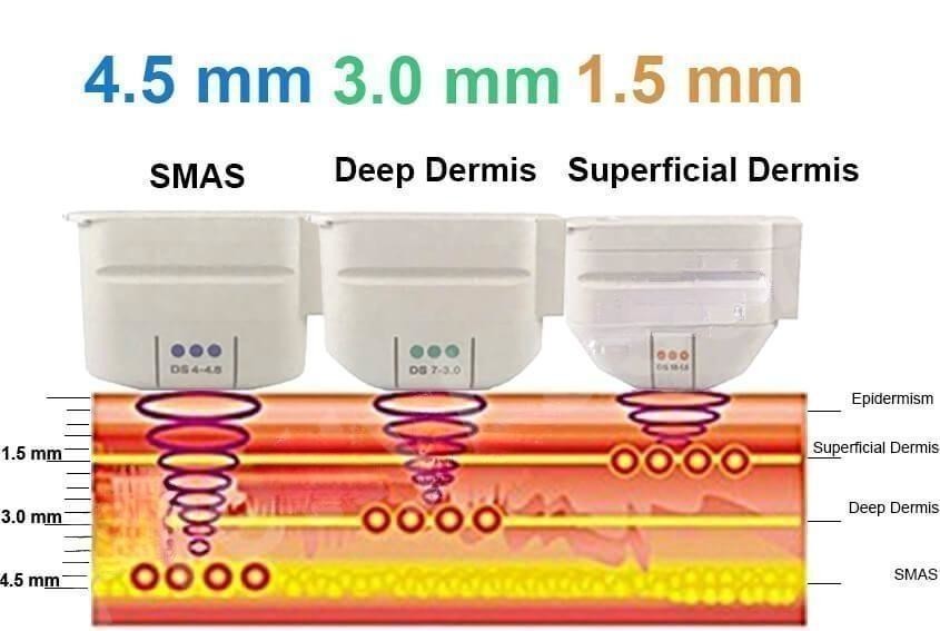 12D Ice Compress Anti-Aging HIFU Professional Fast And Efficient Beauty Machine With 2024 New Product