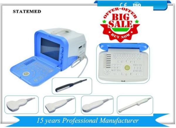 Black / White Veterinary Ultrasound Scanner For Pet Hospital Clinic 2.0 - 8.0