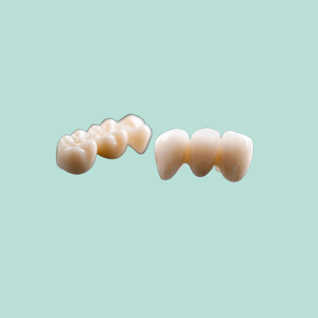 Double Ended Fixed Bridge Crown Gold Alloy Crown Bridge Teeth
