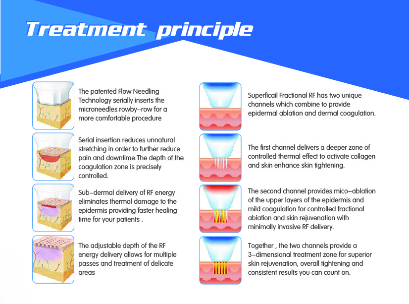Microneedle therapy system fractional microneedle radiofrequency micro needling acne scars