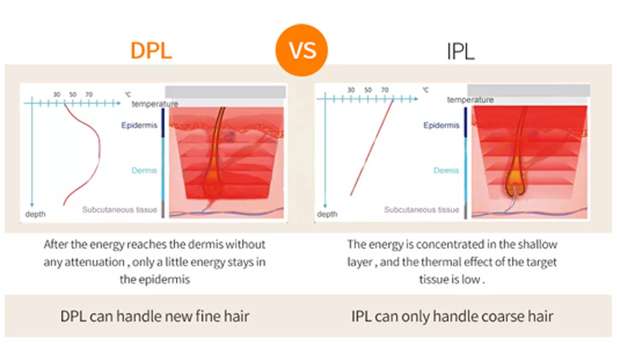 Professional IPL DPL Hair Removal Acne Treatment Skin Rejuvenation Removal Device Permanent Hair Removal Machine