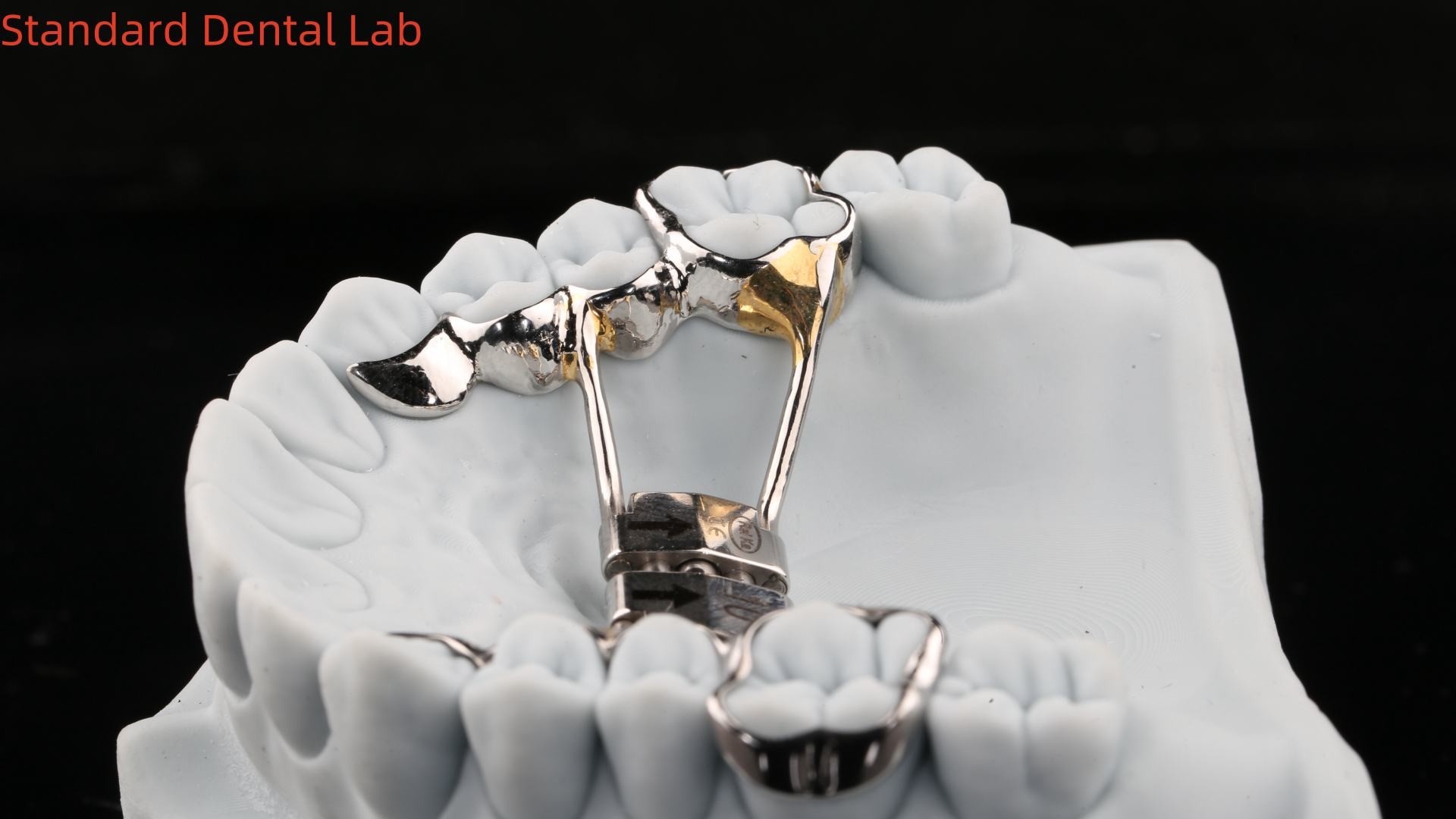 Arch Teeth Palate Expander Stable Hyrax Palatal Expander Perfect Fit SDL Dental Lab Orthodontics Appliance