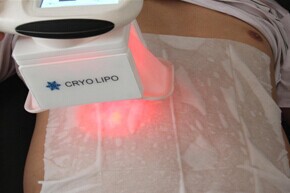 5M RF frequency RF Red Light Laser Body Slimming Machine Cryo Therapy Vacuum Two Handles 92*75.5*44CM