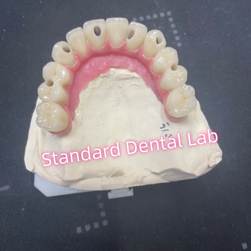 Malo Bridge Hybrid Zirconia All On Four / Six Zirconia Implant Bridge TItanium Bar