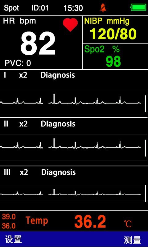 PC200V Handheld 5 Leads Veterinary Vital Signs Monitor NIBP SPO2 TEMP